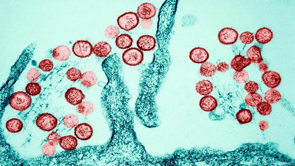 Three dead on Atlantic cruise ship after hantavirus outbreak - here's why that's really weird