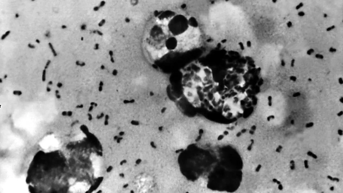 Plague is even older than we thought, and honestly that tracks
